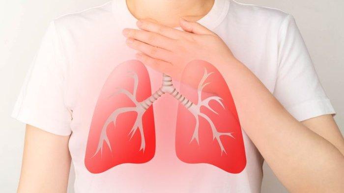 ilustrasi seseorang yang mengalami masalah para paru-paru