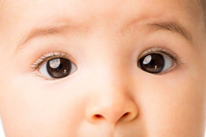 ilustrasi bayi yang mengalami mata juling