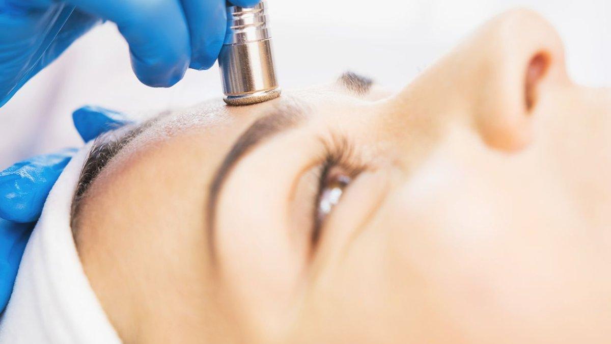 ilustrasi treatment mikrodermabrasi, salah satu treatment untuk atasi kulit kusam