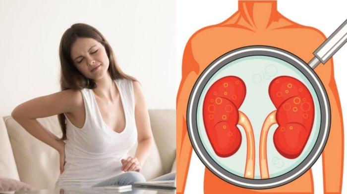 ilustrasi nyeri pinggang akibat adanya masalah pada ginjal