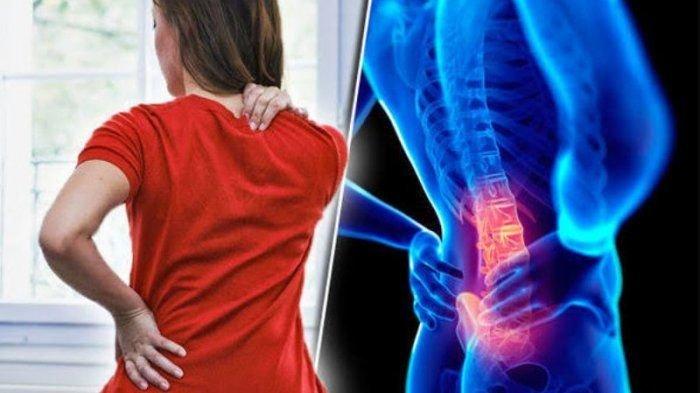 ilustrasi seseorang yang mengeluhkan nyeri tulang belakang