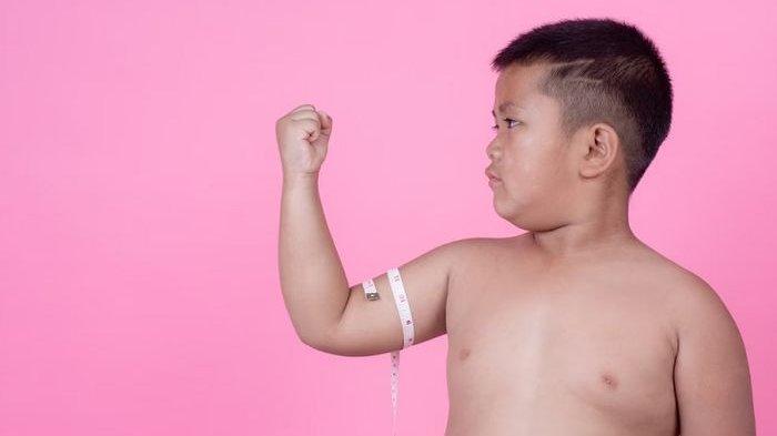 Ilustrasi anak yang mengidap obesitas, berikut kenali dampak jangka panjangnya