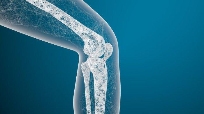 ilustrasi seseorang yang mengalami osteoporosis