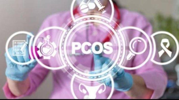 ilustrasi PCOS