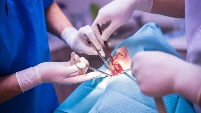 Ilustrasi dokter gigi yang sedang melakukan tindakan operasi gigi bungsu