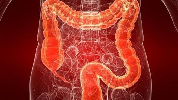 ilustrasi melawan peradangan