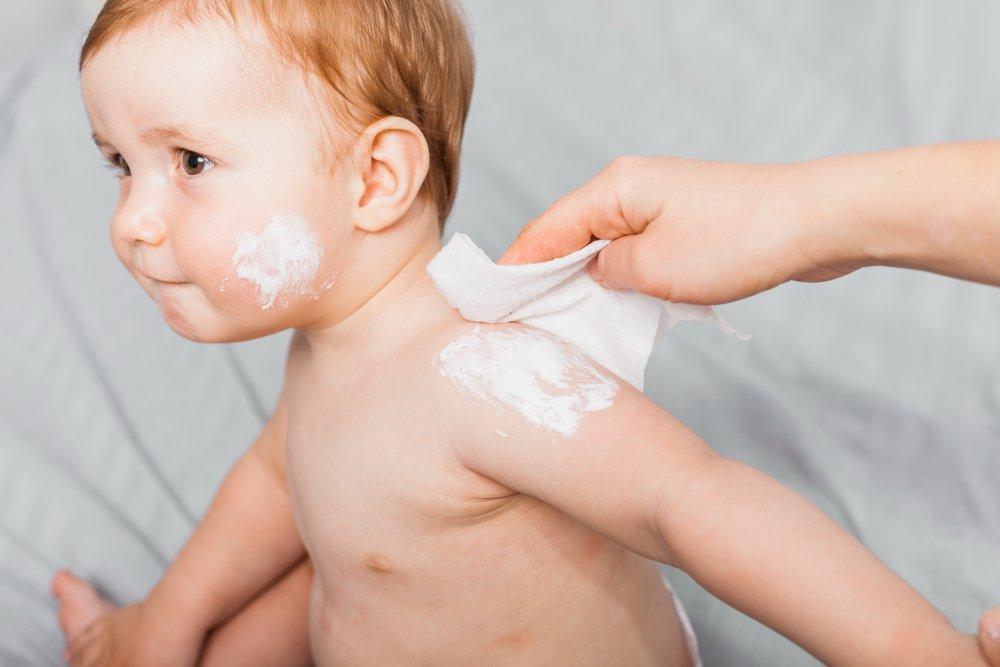 ilustrasi bayi yang memiliki kulit sensitif, berikut hal yang perlu diperhatikan saat kulit bayi sensitif