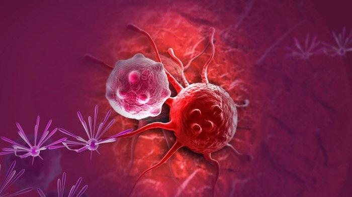 ilustrasi perbedaan kanker dan tumor