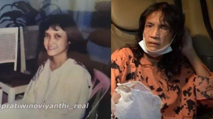 Eks Model Papan Atas Indonesia Hidup Memprihatinkan, Tinggal di