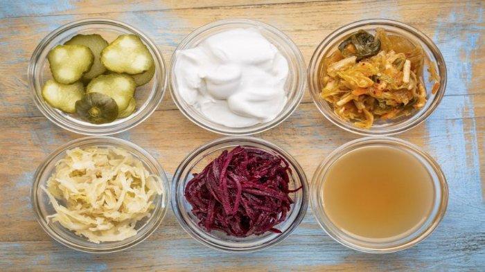Ilustrasi makanan probiotik, salah satu pengobatan rumahan untuk asam lambung