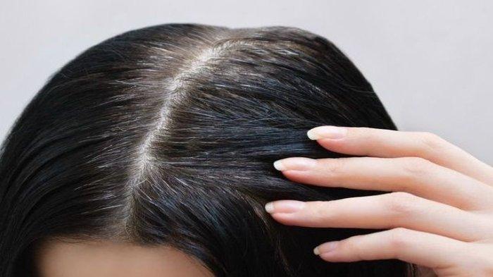 Ilustrasi rambut beruban, apakah lidah buaya dapat mengatasi rambut beruban?