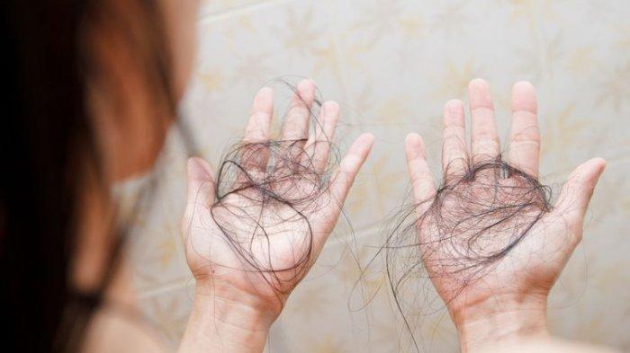 ilustrasi seseorang yang mengalami kerontokan rambut parah