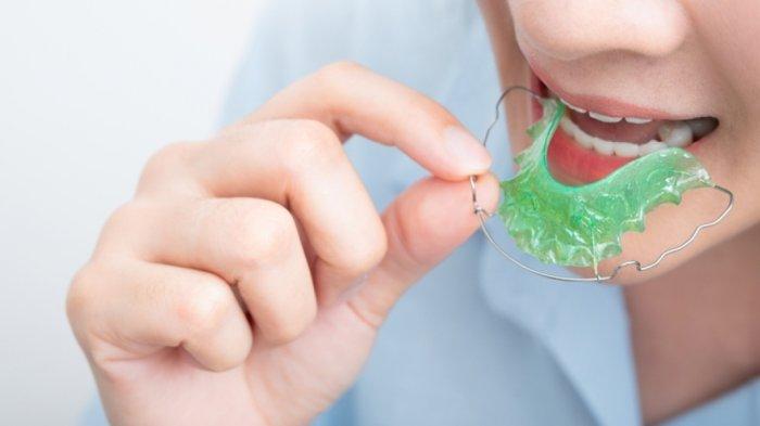 Sebelumnya Tidak Menggunakan Behel apakah Diperbolehkan Menggunakan