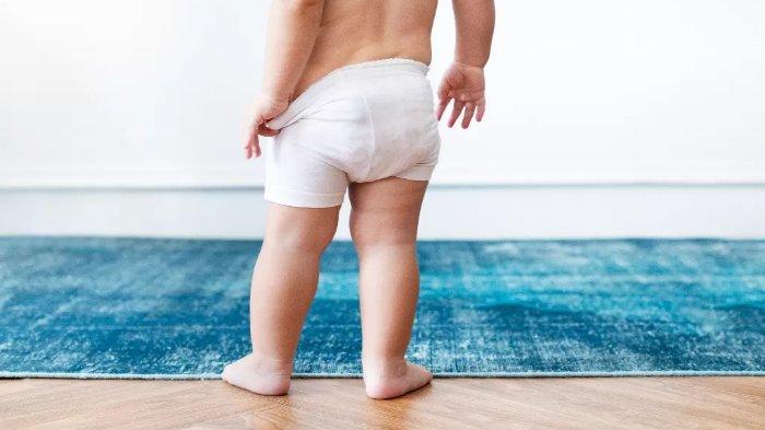 Ilustrasi bayi yang alami ruam popok
