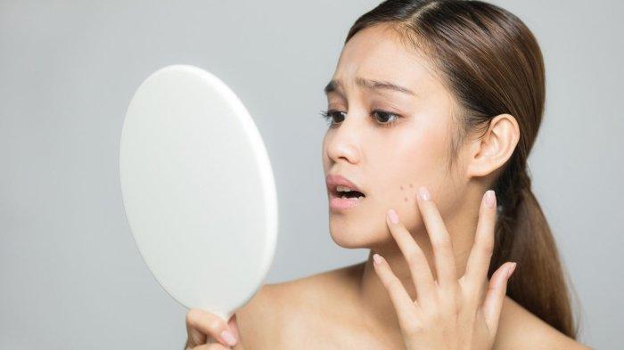 ilustrasi seseorang yang mengalami permasalahan pada skin barrier