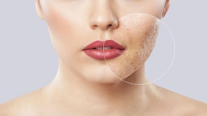 ilustrasi skin barrier yang rusak, berikut penyebab skin barrier rusak