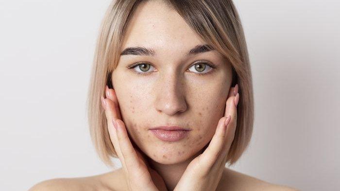 ilustrasi skin barrier yang rusak, berikut ini cara untuk mengatasinya