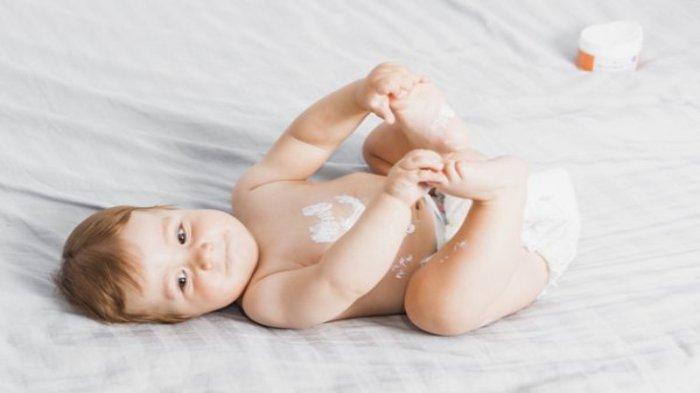Ilustrasi bayi yang mengalami iritasi kulit, berikut ini cara mencegah dan mengatasi iritasi pada kulit bayi