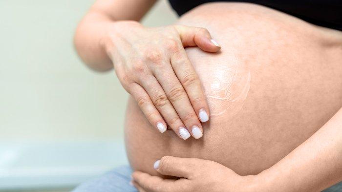 Ilustrasi ibu hamil yang rentan mengalami masalah stretch mark