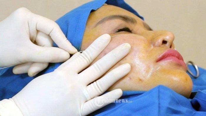 ilustrasi treatment tarik benang