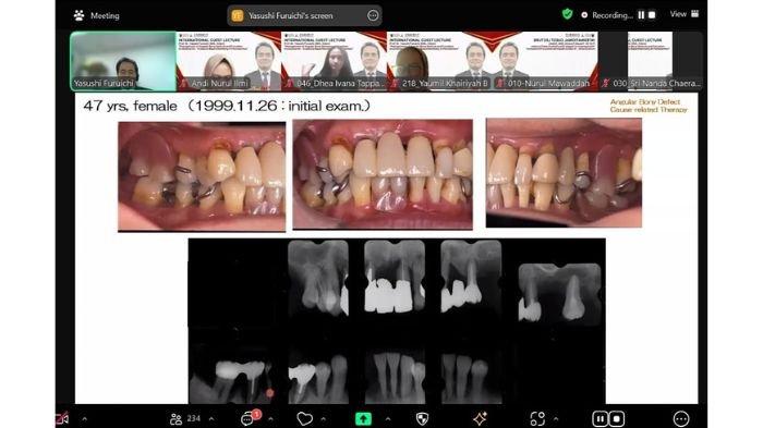 FKG Unhas menyelenggarakan kuliah tamu internasional secara daring, menghadirkan Prof. Dr. Yasushi Furuichi, DDS, Odont, yang juga sebagai Dekan School of Dentistry, Health Sciences University of Hokkaido, Japan.