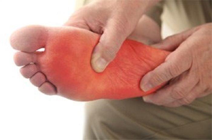 telapak kaki