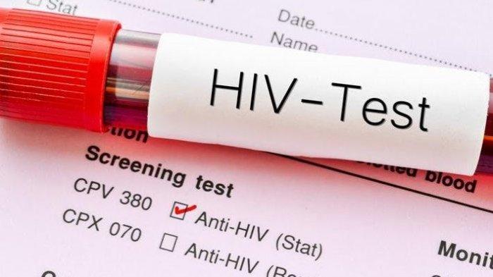 Test HIV