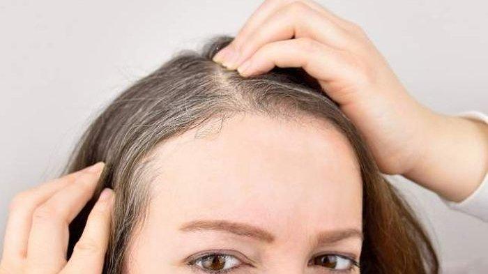 Ilustrasi rambut beruban, berikut tips untuk mencegah terjadinya rambut beruban di usia dini
