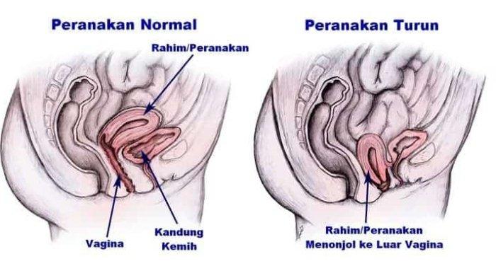 ilustrasi turun peranakan