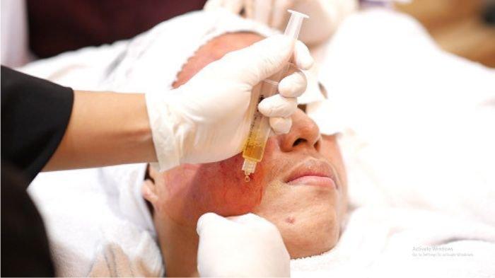 ilustrasi pria yang melakukan treatment PRP atau Vampire facial