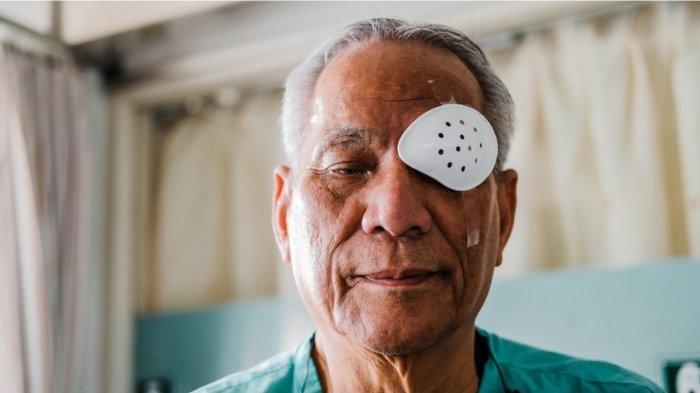 Cara Mengatasi Mata Merah Setelah Operasi Katarak - Tribunjabar.id