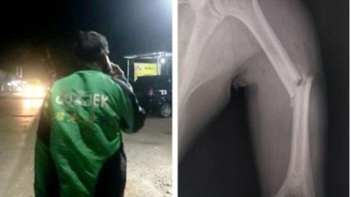 Begini kisah pilu seorang driver ojol yang mengalami kecelakaan dan anak mengidap kanker darah