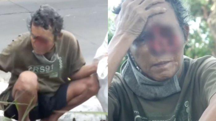 Kisah pilu Mbah Asnawi pemulung wajahnya berlubang dan membusuk karena idap kanker, tiga hari mulung cuma dapat upah Rp10 ribu