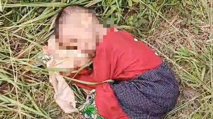 Balita ditemukan di semak belukar dalam kondisi gizi buruk. Dia diduga ditelantarkan orangtuanya.