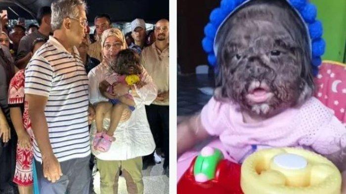 Bayi perempuan bernama Missclyen yang lahir dengan Werewolf Syndrome. Missclyen diundang untu bertemu dengan Raja Malaysia Sultan Yang di-Pertuan Agong Al-Sultan Abdullah Ri'ayatuddin Al-Mustafa Billah dan Raja Permaisuri Agong Tunku Azizah Aminah Maimunah Iskandariah. Gadis itu dijuluki 