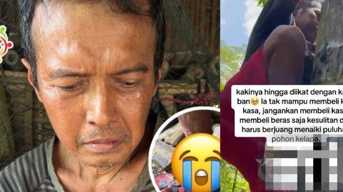 Pak Nana tidak mampu untuk membeli kasa, ia mengikat kakinya yang basah karena rembesan darah dengan karet ban