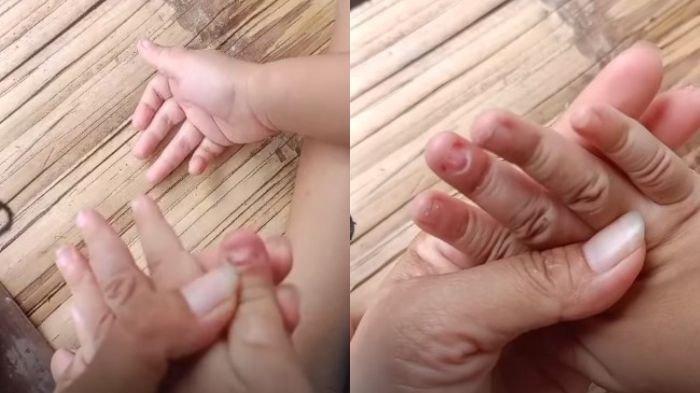Sebuah video memperlihatkan bocah berusia 4 tahun mengalami luka-luka karena dianiaya ayah tiri di Tangerang, Banten, beredar viral di media sosial.