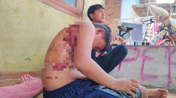 Kondisi bocah 10 tahun yang jadi korban penyiraman air panas oleh buyutnya saat sudah di rumah ayahnya di Desa Lempuyang, Kecamatan Anjatan, Kabupaten Indramayu, Kamis (8/2/2024).