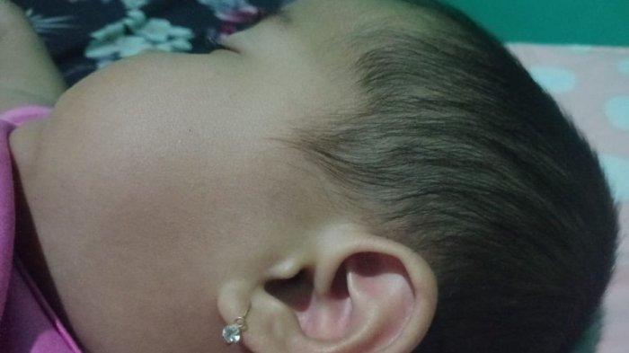 Hanum Hanania bayi cantik berusia satu tahun dari Desa Gempolsari Kecamatan Patokbeusi Kabupaten Subang, telinganya berbentuk mirip lafaz Allah.