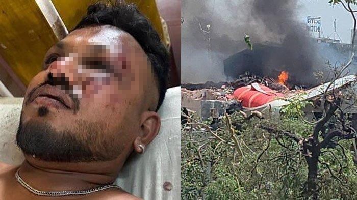 KORBAN SELAMAT DARI KECELAKAAN PESAWAT - Vishwash Kumar Ramesh (40) menjadi satu-satunya penumpang yang selamat dalam kecelakaan Pesawat Air India pada Kamis (12/6/2025) kemarin.