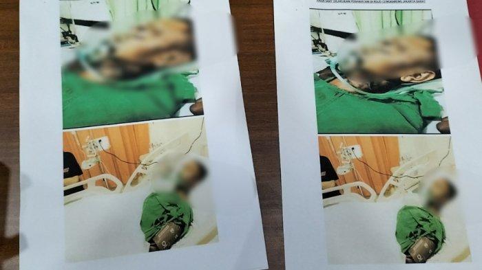Foto-foto FDS (22), korban tewas pengeroyokan di kafe remang-remang lokalisasi Gang Royal, Penjaringan, Jakarta Utara, Senin (10/7/2023) silam.