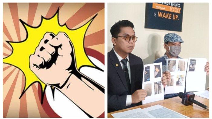 Pengacara MRR, Muhamad Normansyah (kiri) dan paman MRR, Yusman, saat menunjukkan barang bukti foto luka dialami MRR akibat penyiksaan, Jakarta Timur, Minggu (7/7/2024).