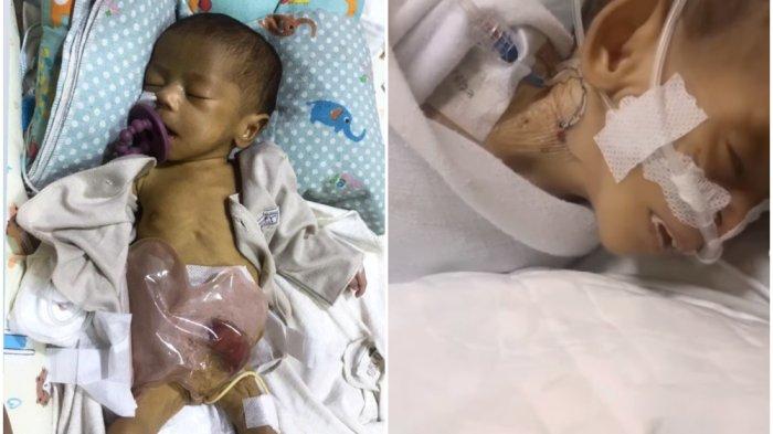 Seorang ibu, Chintia, membagikan cerita di media sosial tentang dugaan kelalaian oleh tiga perawat Rumah Sakit Anak dan Bunda (RSAB) Harapan Kita, Jakarta Barat, saat menangani anaknya, Lanala Ayudisa Halim (2 bulan). 