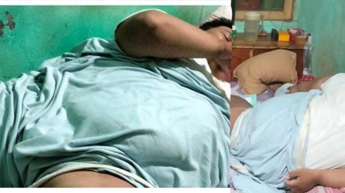 Terungkap kondisi terkini tukang ojek di Tangerang yang mengalami obesitas sampai 230 kilogram. Pria bernama Engky (32) itu ternyata menderita beberapa penyakit serius.