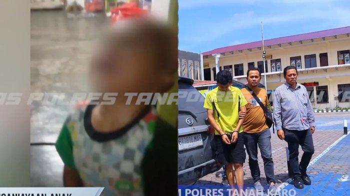 Terungkap tampang ayah di Tigapanah, Karo, Sumatera Utara yang tega aniaya anak kandungnya yang masih berusia 4 tahun sampai terluka di hidung. Pria berinisial J (42) itu hanya menunduk ketika digiring ke kantor polisi untuk mempertanggungjawabkan perbuatannya.