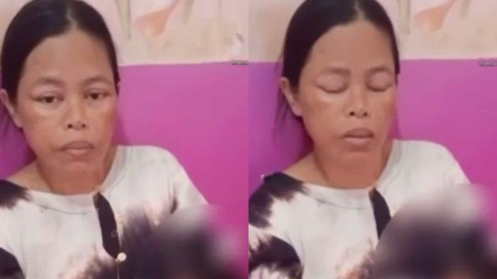 Seorang wanita bernama Titin Rohayatin membuat video permintaan tolong kepada pemerintah hingga Presiden Joko Widodo lantaran tak diizinkan pulang dari RS Erni Medika, Desa Talang Bakung, Kecamatan Paal Merah, Kota Jambi. Titin tak diizinkan pulang lantaran belum bisa melunasi pembayaran persalinan caesar di rumah sakit tersebut.