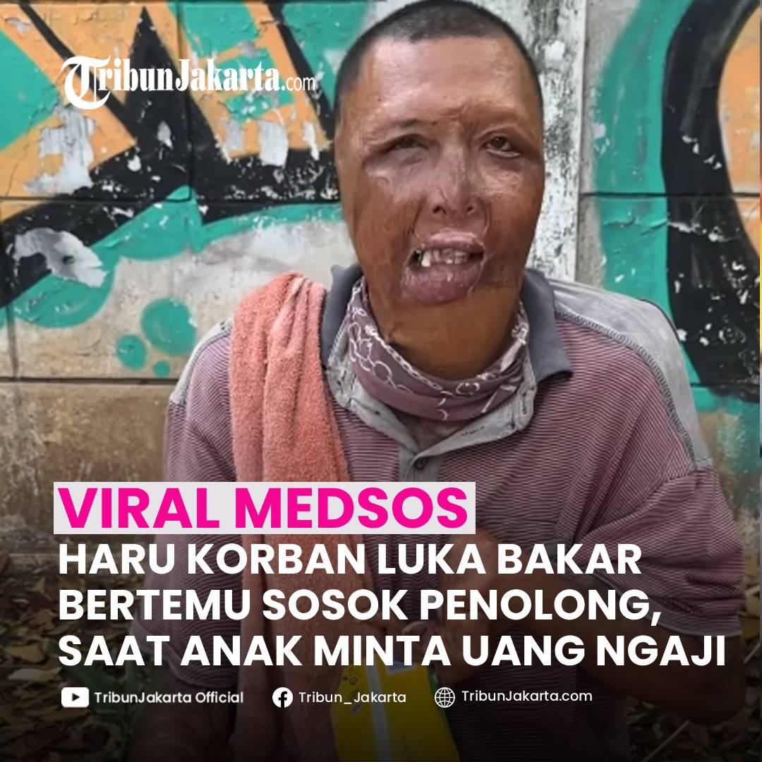 KLIK SELENGKAPNYA: Pilu Korban Luka Bakar Jualan Tisu Belum Laku Seharian. Akhirnya Bertemu Penolong Saat Anak Minta Uang Ngaji.
