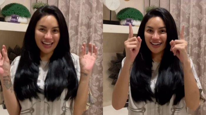 Nikita Mirzani Dipuji Makin antik usai Operasi hidung