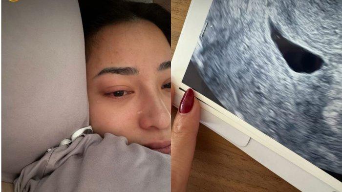 Nikita Willy Keguguran anak Kedua