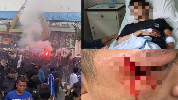 Dua suporter PSIS Semarang yang menjadi korban represif kepolisian selepas di kawasan Stadion Jatidiri, Kota Semarang, Minggu (22/12/2024) sore. 
